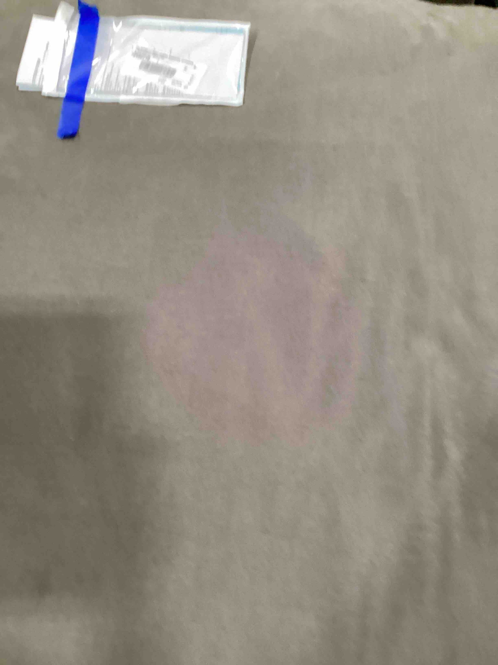 Product Image - Damaged